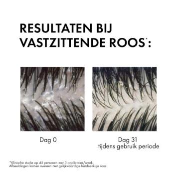 Vichy Dercos Shampoo Anti roos - Normaal tot Vet haar 390ml