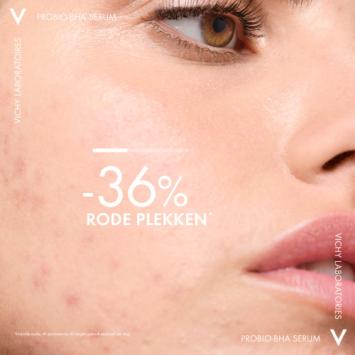 Vichy Normaderm Probio - BHA Serum Anti-Onzuiverheden 30ml