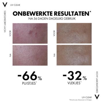 Vichy Capital Soleil UV Clear Anti-onzuiverheden Gezicht SPF50+ 40ml